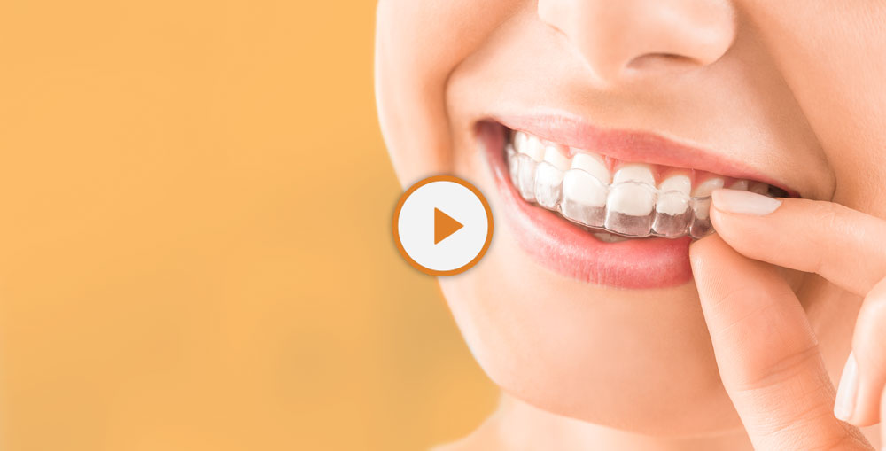 dental patient wearing Invisalign - dentist in Billings, MT