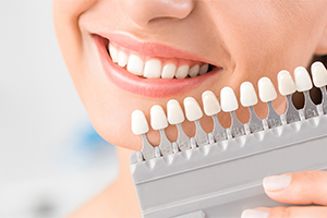 Teeth Whitening at Thomas Smile Designs in Billings, MT