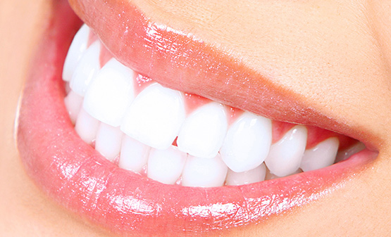 Pearly white smiles at Thomas Smile Designs