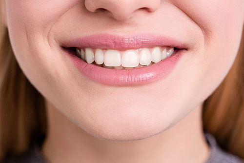 Pearly white smile at Thomas Smile Designs