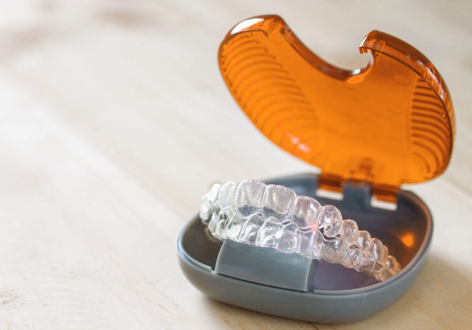 Invisalign dental model - dentist in Billings, MT